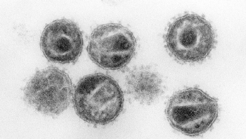 Aids, il vaccino "italiano" potenzia le difese contro il virus Hiv