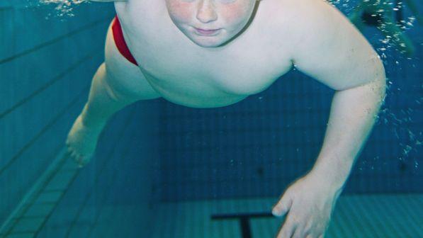 World Obesity Day, sos dell'Oms: bimbi 10 volte più obesi rispetto al 1975
