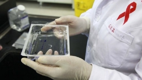Hiv, scoperto inibitore naturale: la proteina cellulare Serinc5