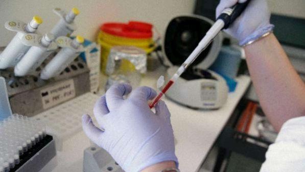 Genova, donna muore a 36 anni stroncata da meningite batterica
