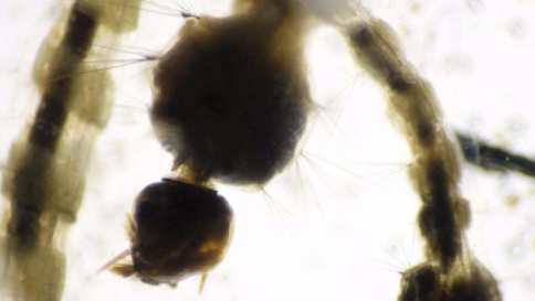 Zika, infettato cervello adulto