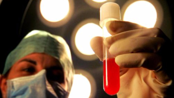 Riportare in vita i morti, il progetto shock lanciato da una società biotech americana