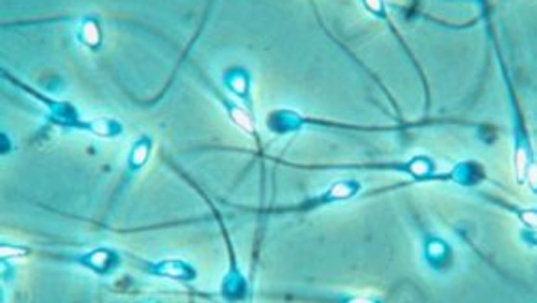 Infertilità, un nuovo test individua gli spermatozoi "migliori" per procreare