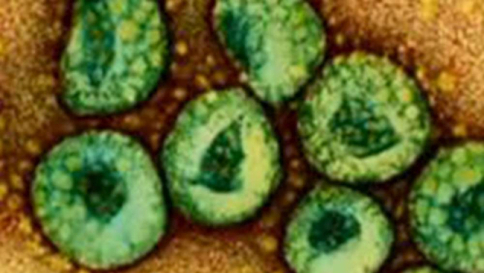 Dall'Ebola all'allarme carni: i 10 argomenti di salute più discussi e seguiti del 2015