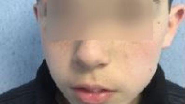 Foto shock bullismo su Facebook,il papà: "Ho fatto la scelta giusta"