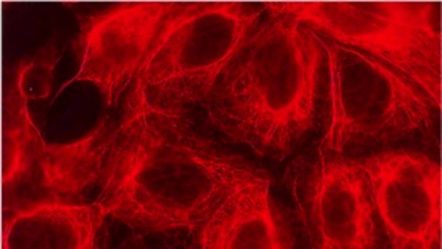 Tumori, realizzato un biochip che riconosce e rimuove le cellule malate