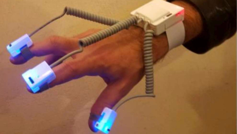 Ricerca italiana, contro il Parkinson arriva un "bracciale smart" per la diagnosi precoce