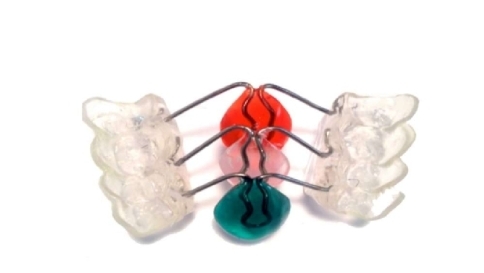 Da una ricerca italiana arriva il bite per denti che aiuta a perdere peso