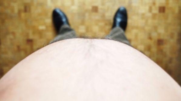 Obesità più letale di fumo e diabete: causa il maggior numero di anni di vita persi