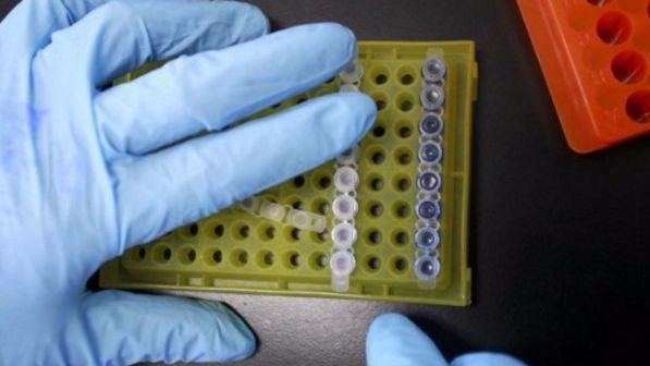 Cancro al seno, scoperti i geni capaci di predire il rischio metastasi