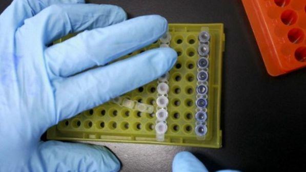 Diabete, ricercatrice italiana scopre la molecola con un ruolo chiave nella malattia