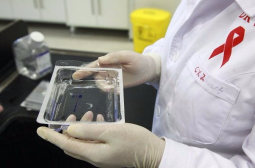 Contagio Hiv a Roma, per la Procura almeno 29 le vittime di Valentino T.