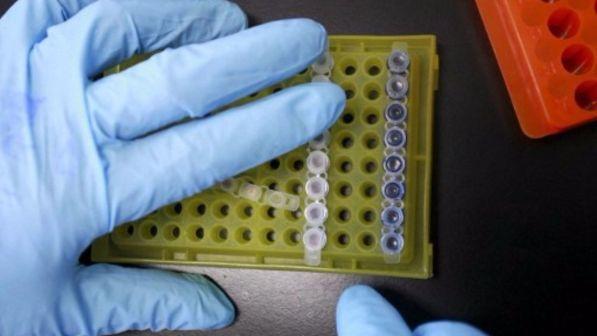 Scoperta proteina bifronte, può bloccare tumore polmone