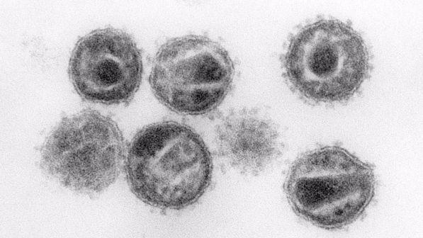 Aids, una proteina "intelligente" può bloccare l'azione del virus
