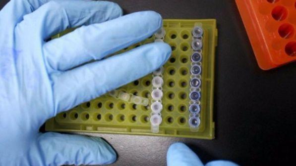 Proteina contro il cancro al seno, l’esperto a Tgcom24: “Abbiamo aperto la strada verso nuove possibili terapie”