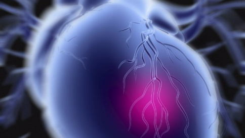 Arriva il cerotto bionico per "riparare" il cuore dopo l'infarto