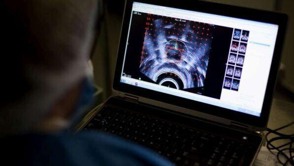 Tumori, radiazioni più mirate bloccano le metastasi multiple al cervello