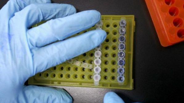 ricerca, medicina, analisi, laboratorio