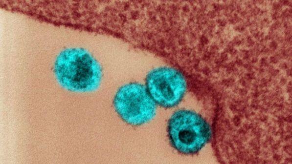 Aids, per rimuovere l'Hiv dormiente dal sangue arrivano le "forbici molecolari"