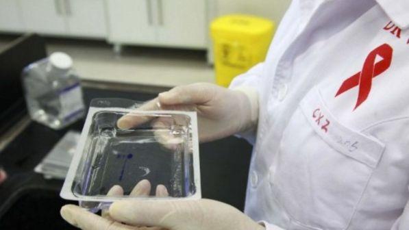 Infezioni da Aids, l'allarme dell'Istituto Superiore di Sanità: pochi progressi tra i giovani