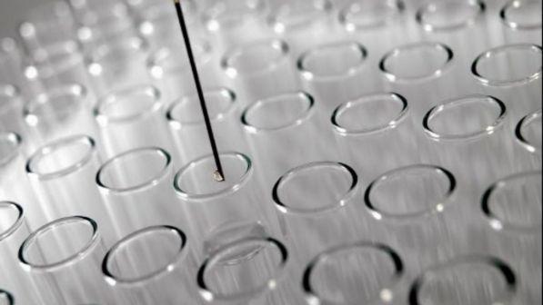 Incidente in laboratorio chimica università Milano: 4 intossicati