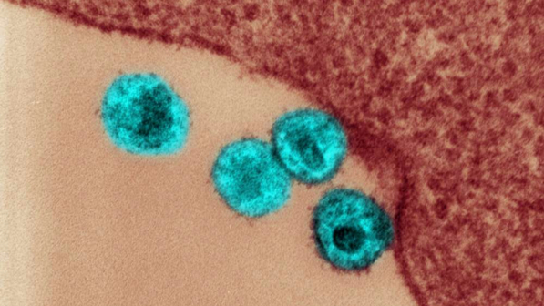 Aids, svelato come il virus Hiv fa breccia nel nucleo delle cellule: nuove speranze per la prevenzione