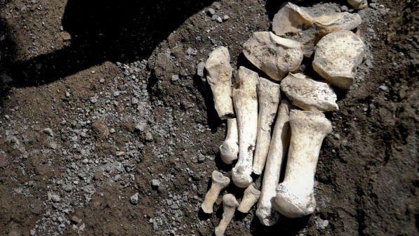 Evidenziato tumore su scheletro del I sec d.C., scoperta a Catania