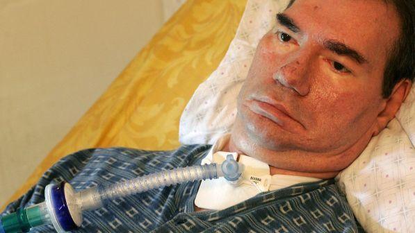 Dieci anni dalla morte di Piergiorgio Welby, il 77% degli italiani vuole che l'eutanasia sia un diritto