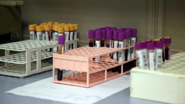 Sos sangue: gli ospedali temono di restare a secco in autunno
