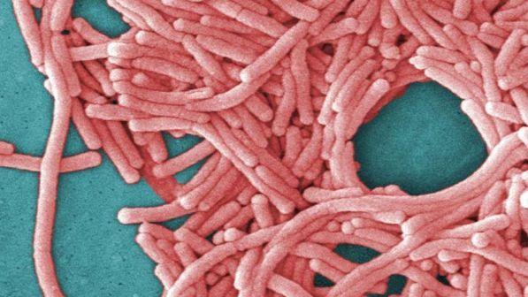 Legionella: 2 nuovi casi a Bresso, salgono a 48 i contagiati