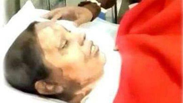 Pakistan, morta Asima: la giovane cristiana arsa viva