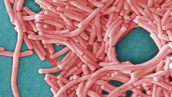Legionella,salgono a 33 le persone contagiate: 6 nuovi casi a Bresso
