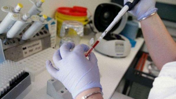Meningite, 35enne ricoverato in ospedale a Parma: è grave