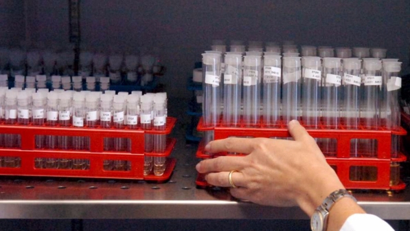 Leucemia, l'Ue approva una terapia che "arma" il sistema immunitario contro i tumori del sangue