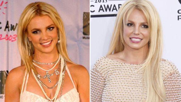 Britney Spears rifatta? Chirurgo assicura: "Occhi, naso e labbra ritoccati"