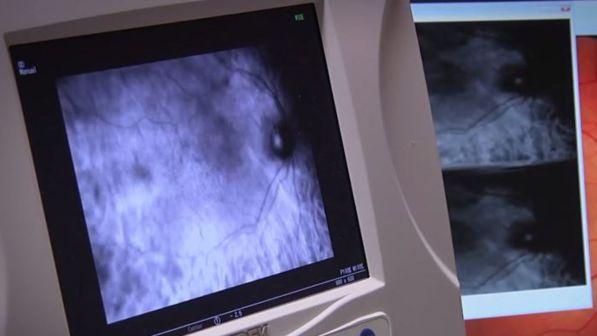 Da chi mangia metallo a chi suda sangue, i 10 casi medici più strani del 2017