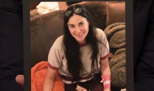 Demi Moore, confessione shock in tv: "Ho perso due denti per lo stress"