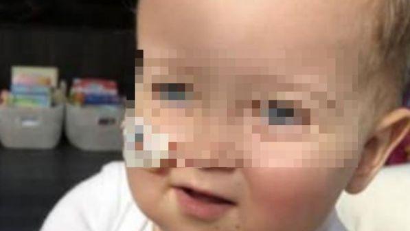 Alex, condizioni stabili dopo il trapianto all'ospedale Bambino Gesù di Roma