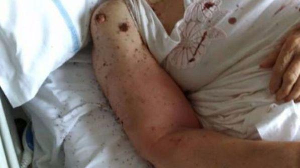 Formiche in ospedale, blitz dei Nas al San Paolo di Napoli