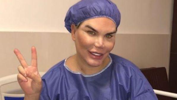 Rodrigo Alves, il Ken Umano si "riduce" la faccia in Iran