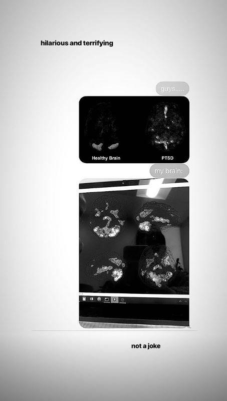 Ariana Grande posta immagine con scansione del suo cervello "malato" da stress post traumatico