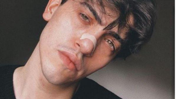 Michele Bravi dopo l'incidente: "Non ho parlato per mesi, ora sto tornando alla realtà"
