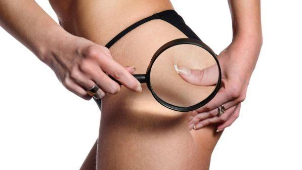 Cellulite: comincia la guerra di primavera