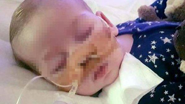 Caso Charlie Gard, la politica italiana si schiera contro lo stop alle cure