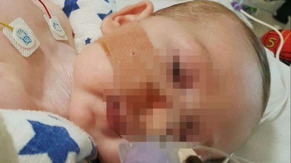 Charlie Gard, Cei: "La vita va difesa, siamo con i genitori"