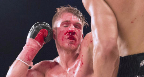Boxe, Nick Blackwell in coma indotto