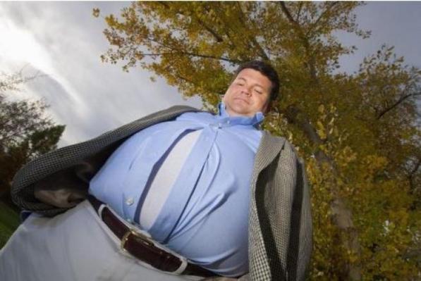 North Yorkshire, stop a interventi chirurgici per obesi e fumatori: troppi tagli al sistema sanitario