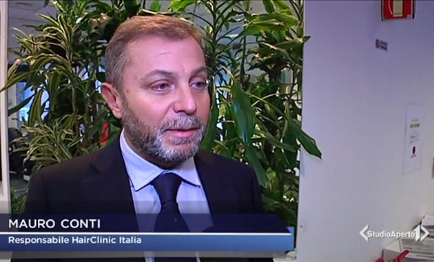 speciale calvizie