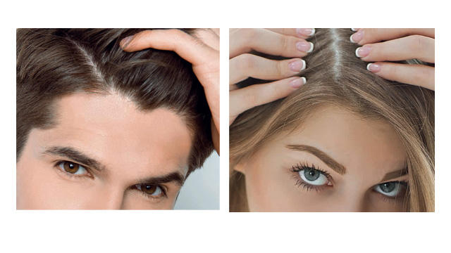 Calvizie Un Rimedio Naturale Dalla Melannurca Igp Campana Tgcom24