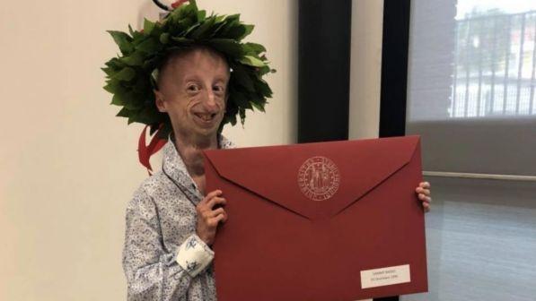 La forza di Sammy Basso:"Grazie alla progeria sto diventando ricercatore"